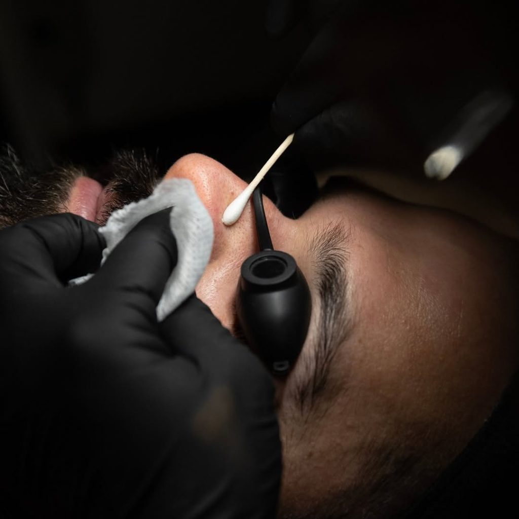 blackheads men skincare